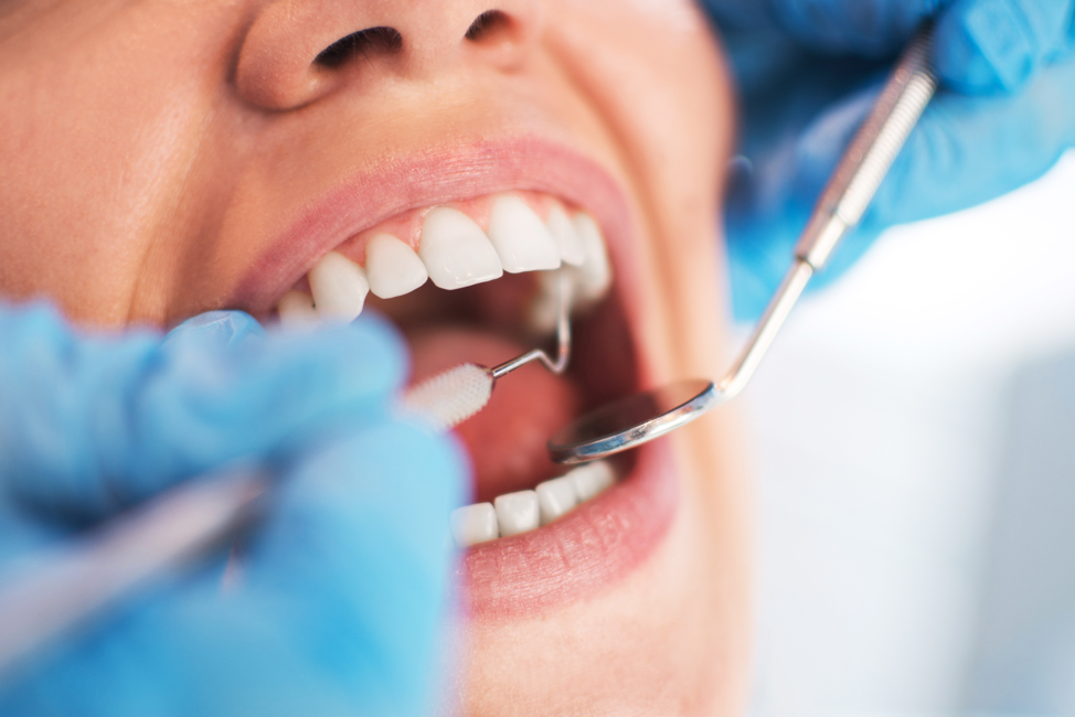 The Vital Link Between Oral Health and Overall Health dental health